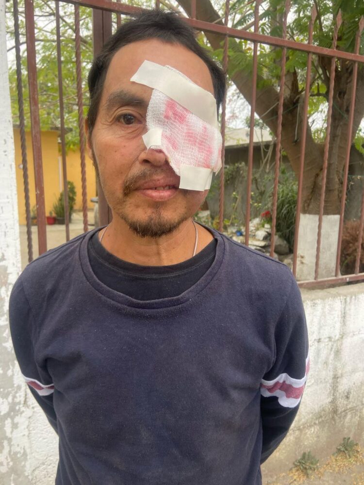 EL SEÑOR JOAQUIN CORONA QUIEN TIENE CÁNCER DE PIEL, HACE UN LLAMADO AL BUEN CORAZÓN DE LOS POTOSINOS.