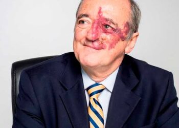 MÁS DE 70 MIL PERSONAS FINANCIAN ESPERANZA EN LA LUCHA CONTRA EL CÁNCER.